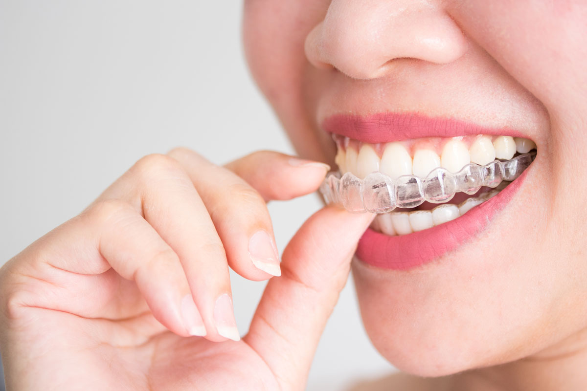 https://shifadentalperumpilavu.com/wp-content/uploads/2022/06/orthodontics.jpg
