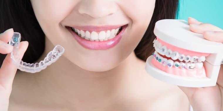 https://shifadentalperumpilavu.com/wp-content/uploads/2022/07/aligner.jpg