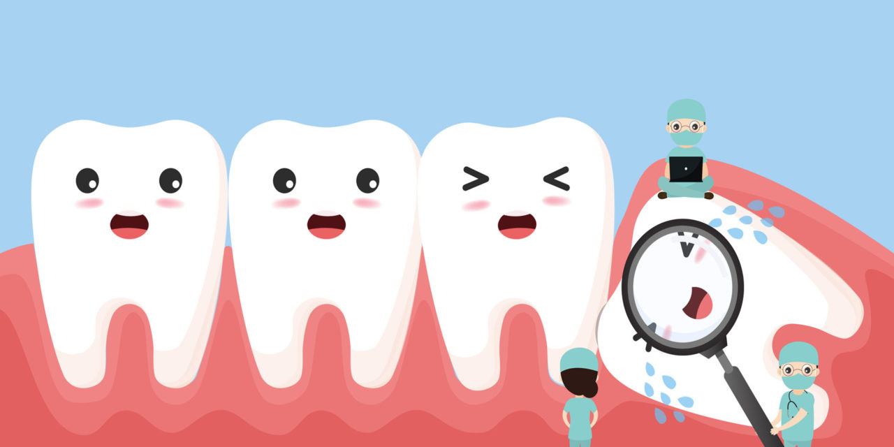 Normal and wisdom tooth removal