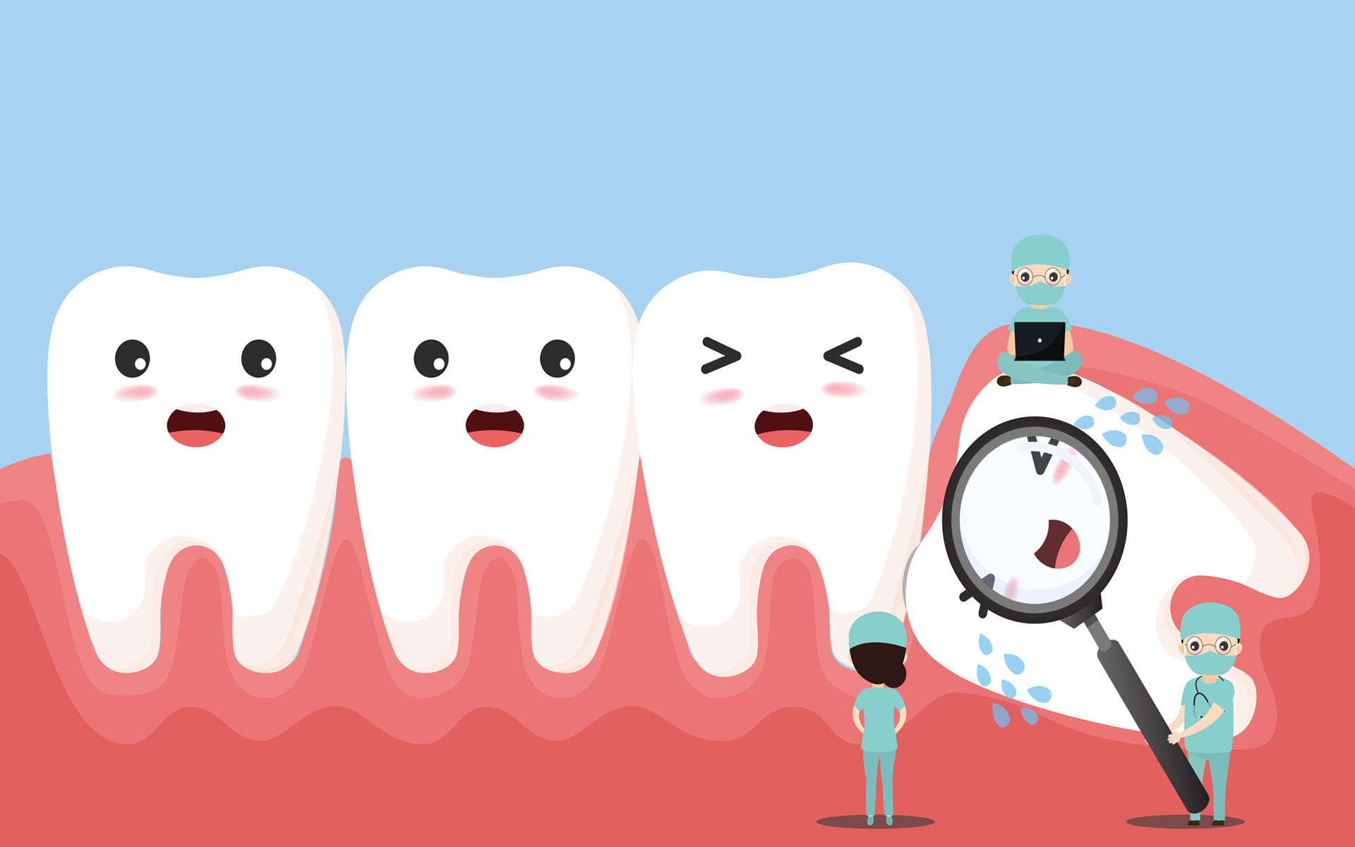 3RD MOLAR IMPACTION