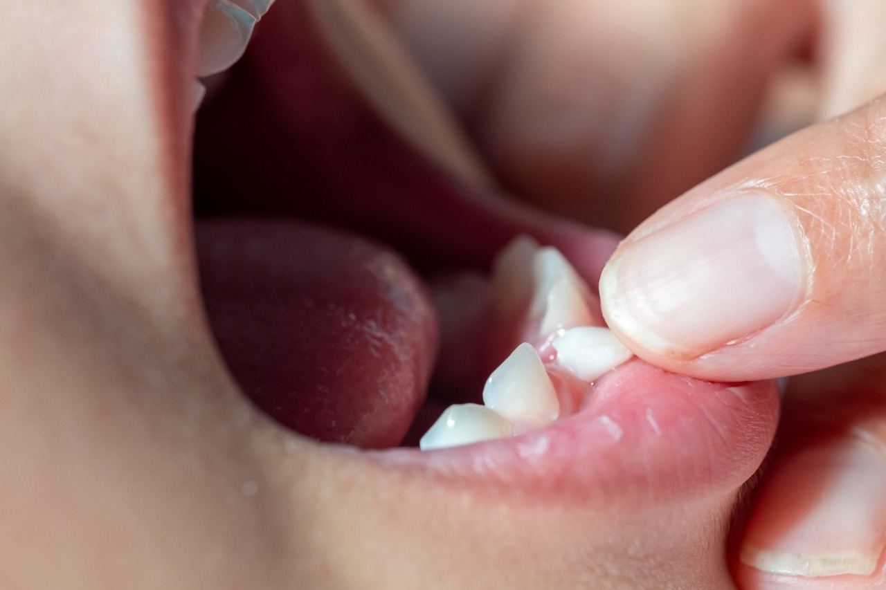 https://shifadentalperumpilavu.com/wp-content/uploads/2022/08/Tooth.jpeg