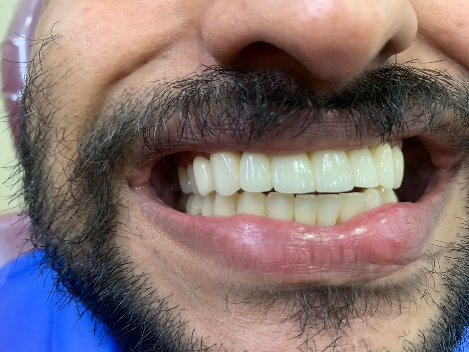 https://shifadentalperumpilavu.com/wp-content/uploads/2022/08/after.jpg