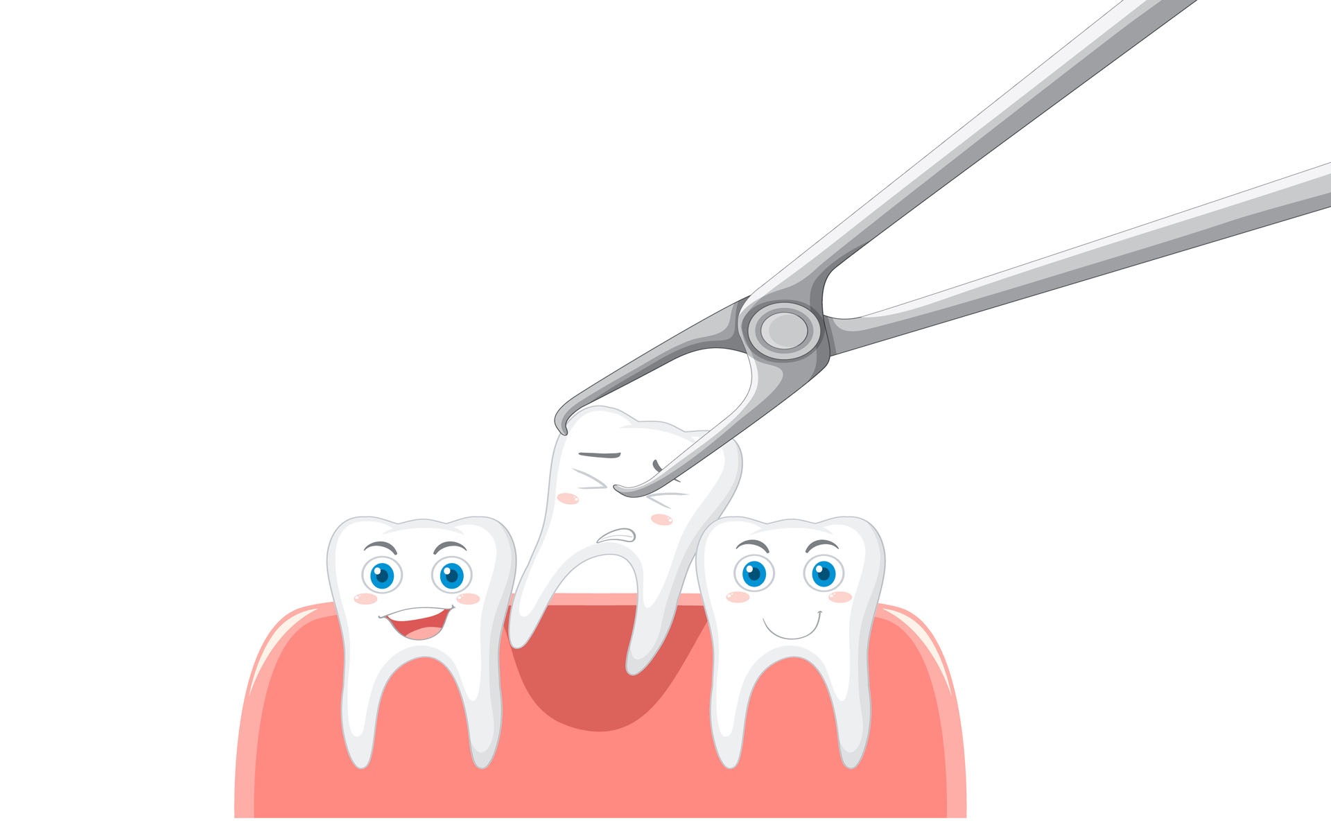 tooth-extraction