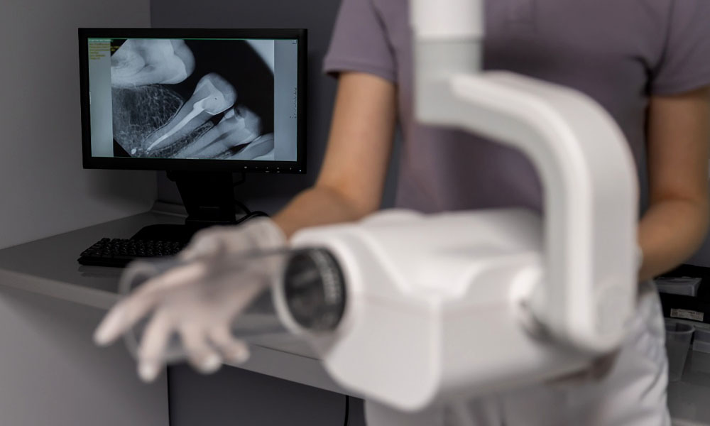 RVG OR DIGITAL XRAY