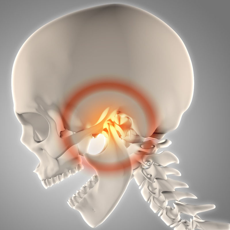 Temperomandibular joint -disorders