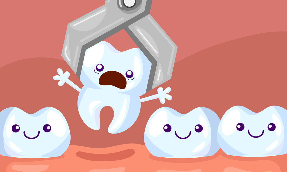 Teeth Removal thrissur