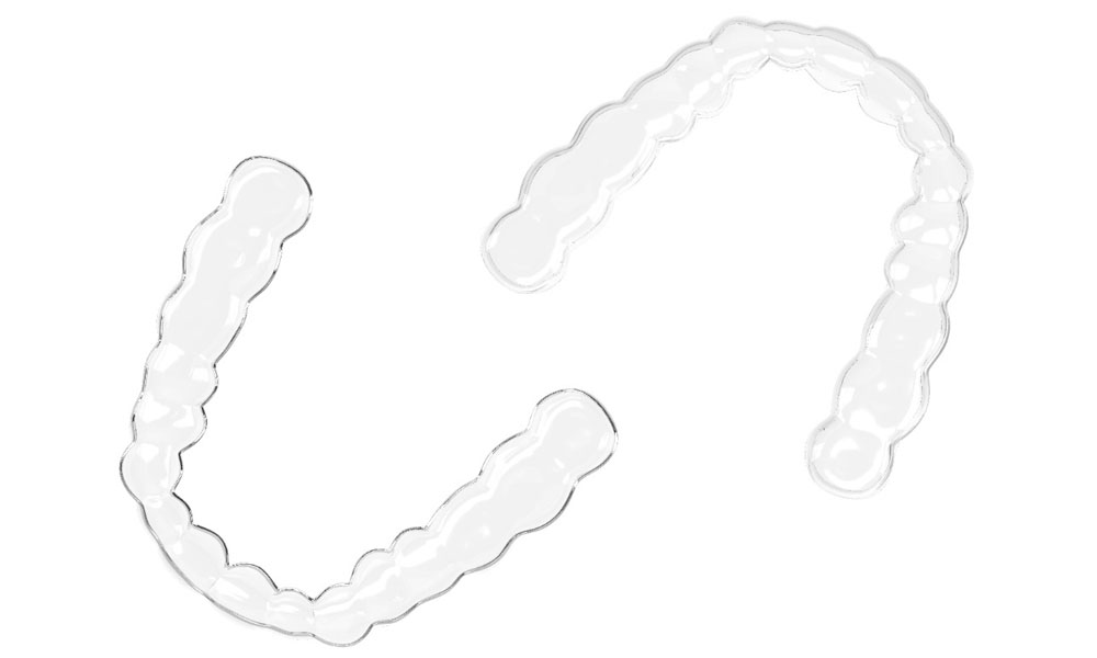 CLEAR RETAINERS https://shifadentalperumpilavu.com/wp-content/uploads/2022/10/CLEAR-RETAINERS.jpg