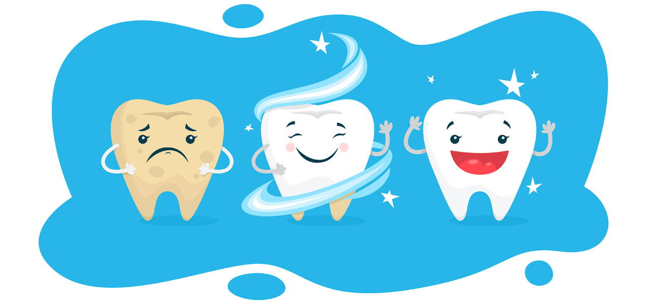 TEETH BLEACHING https://shifadentalperumpilavu.com/wp-content/uploads/2022/10/TEETH-BLEACHING.jpg