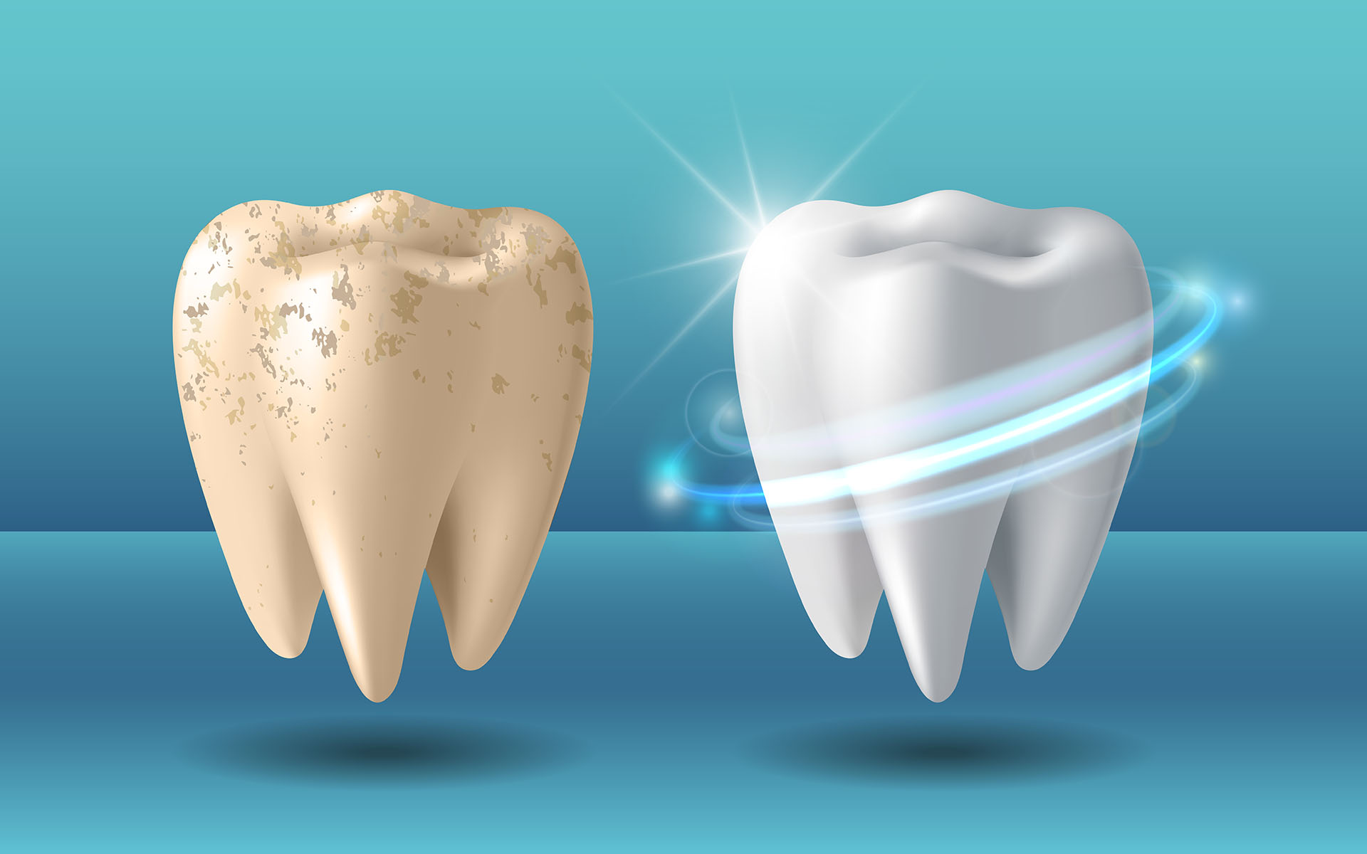 https://shifadentalperumpilavu.com/wp-content/uploads/2022/11/teeth-cleaning-or-scaling.jpg